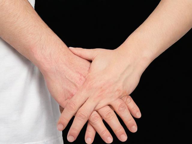 绍兴狐臭手术多少钱？狐臭微创手术费用全解析
