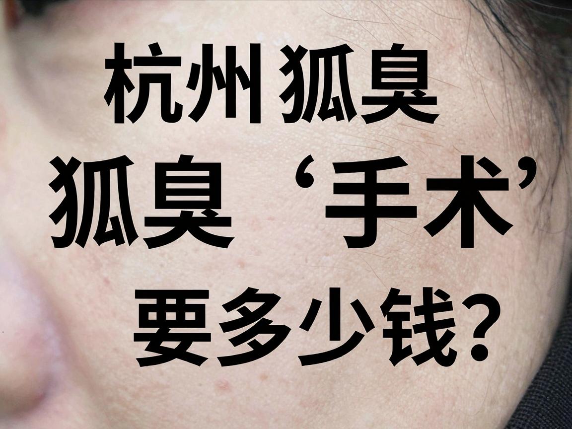 杭州狐臭手术要多少钱？一文讲清狐臭手术价格与费用明细