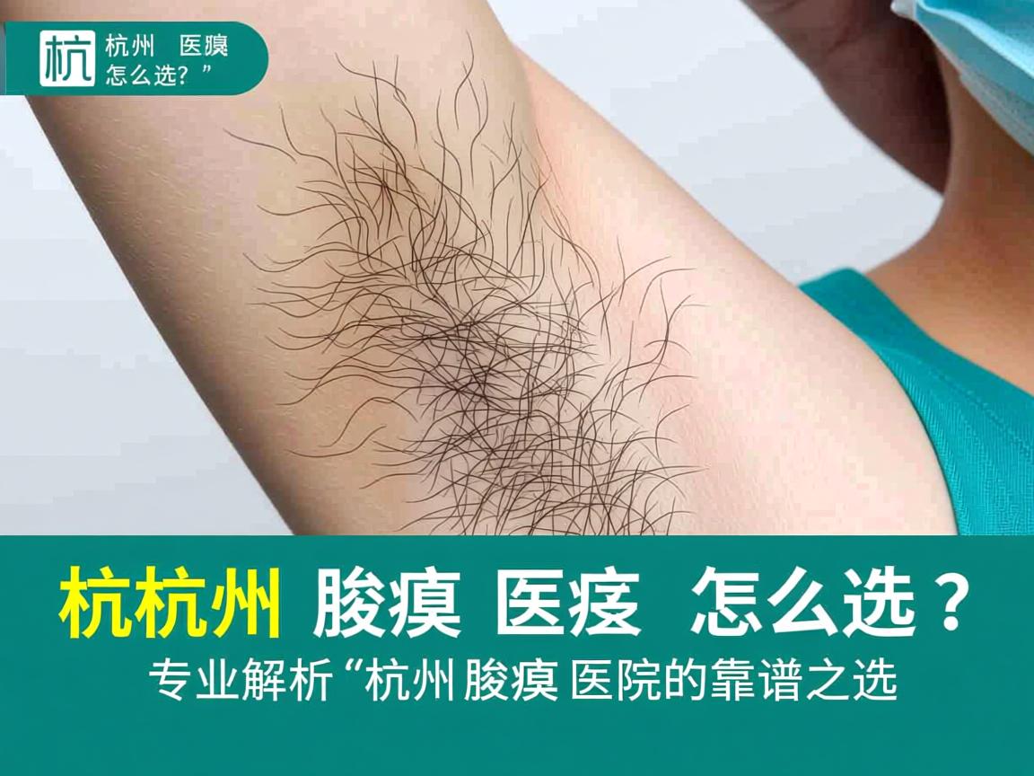 杭州腋臭医院怎么选?专业解析杭州腋臭医院的靠谱之选 杭州腋臭医院怎么选?专业解析杭州腋臭医院的靠谱之选