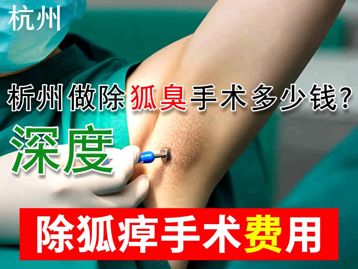 杭州做除狐臭手术多少钱？深度解析除狐臭手术费用